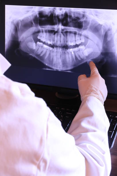 Best Emergency Dentist for Lost Fillings or Crowns in New Haven, CT
