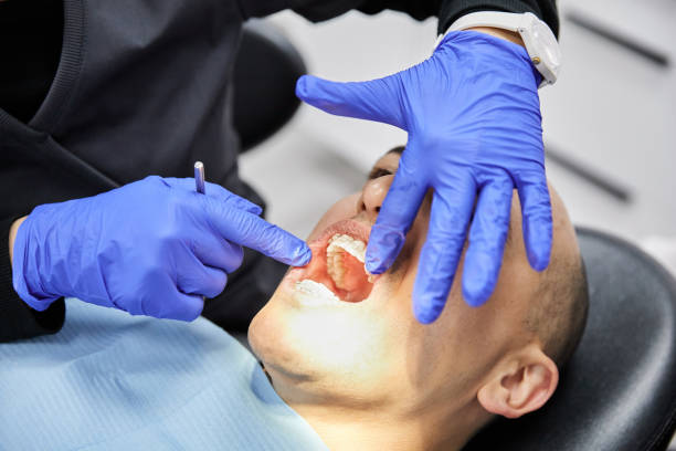 Best Emergency Dental Extractions in New Haven, CT