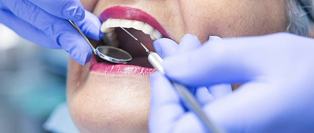 Best Emergency Dentist for Knocked-Out Tooth in New Haven, CT